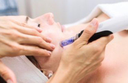 ハイコックス水光注射の施術 画像