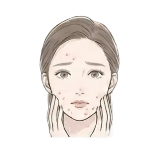 ニキビ・ニキビ跡 悩んでいる女性 画像