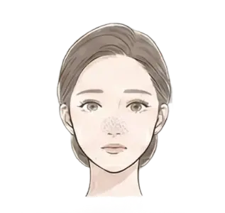 毛穴の黒ずみ・つまり 悩んでいる女性 画像